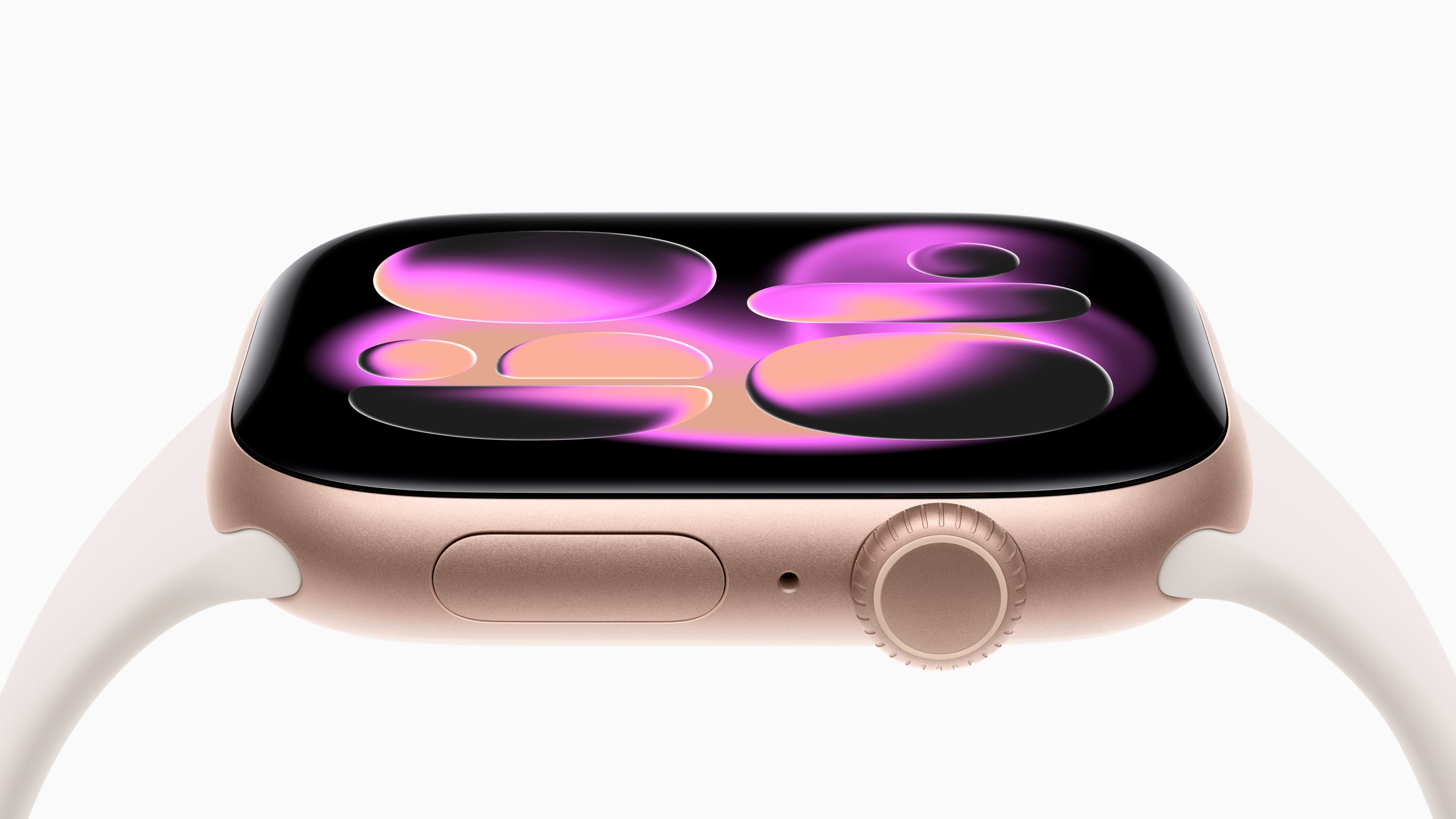 Apple Watch Series 11 – התראות יתר לחץ דם, מדד Sleep Score, חיי סוללה ארוכים יותר ועיצוב עמיד במיוחד